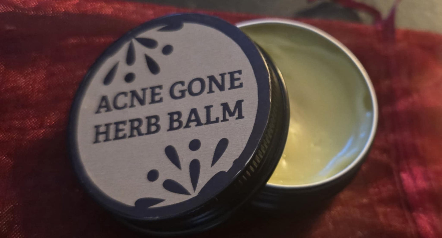 🌼 Herb ’n Clear Acne Balm🌼